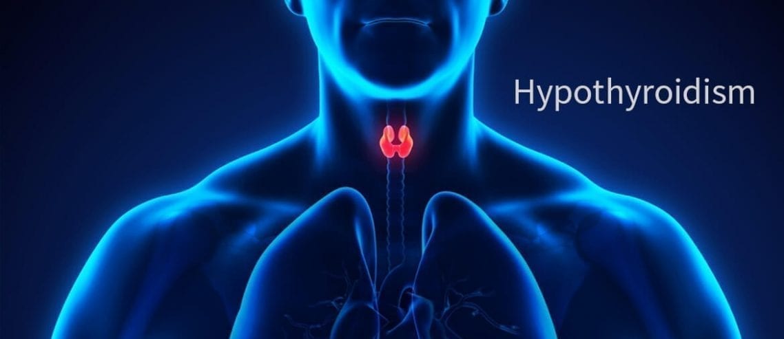 Hypothyroidism