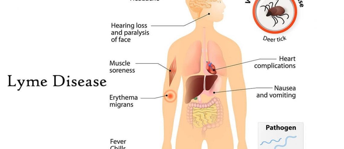 cure for Lyme disease